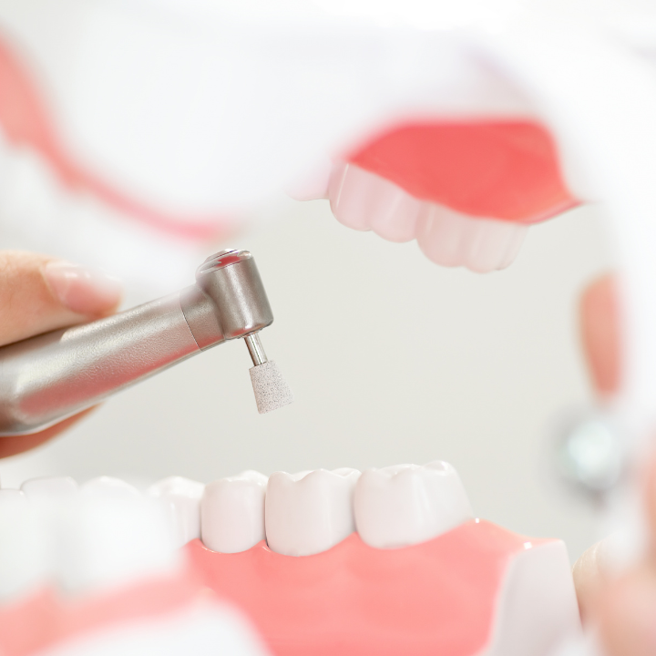 Limpeza e profilaxia dental em Joinville
