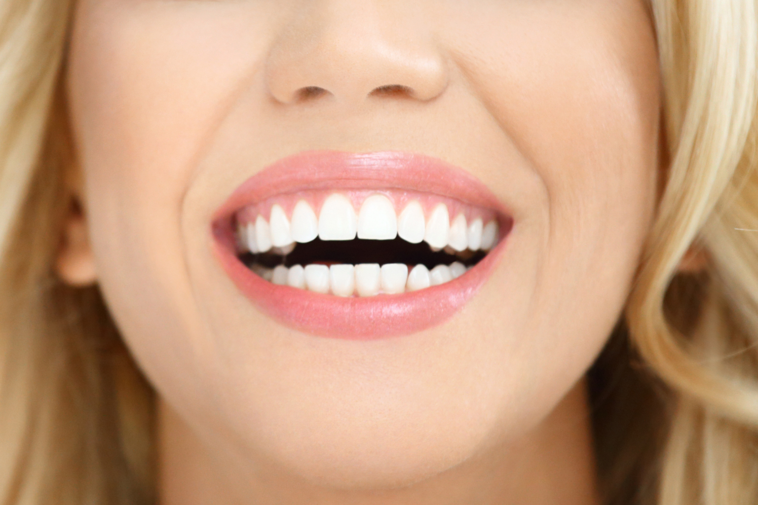 Antes e depois de clareamento dental e restauração estética